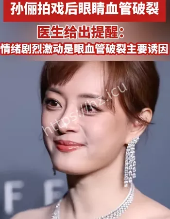 孙俪眼睛血管破裂